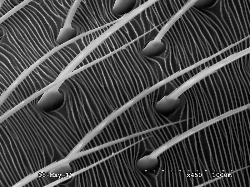 Microscopic view of hair follicles