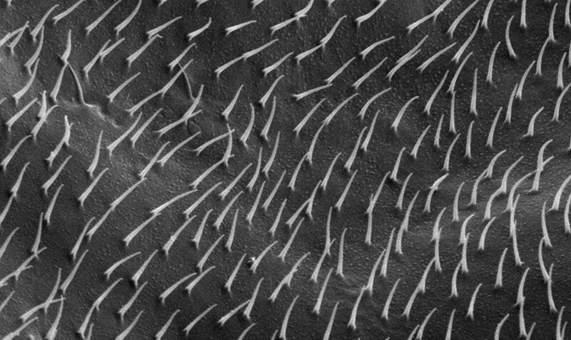 microscopic view of hair follicles