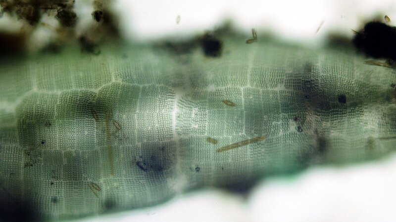 microscopic view of plant tissue