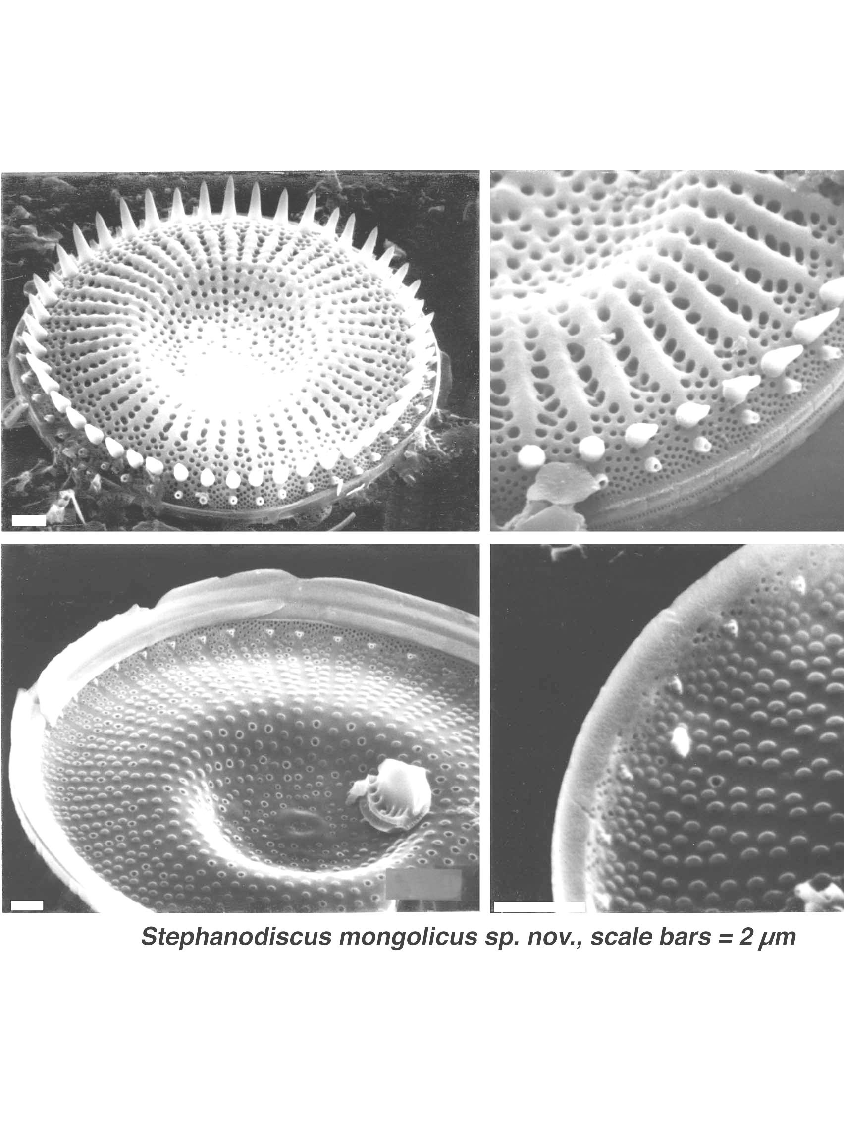 Microscopic view of Stephanodiscus mongolicus