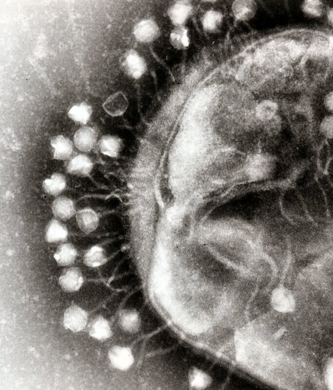 Microscopic view of virus particles
