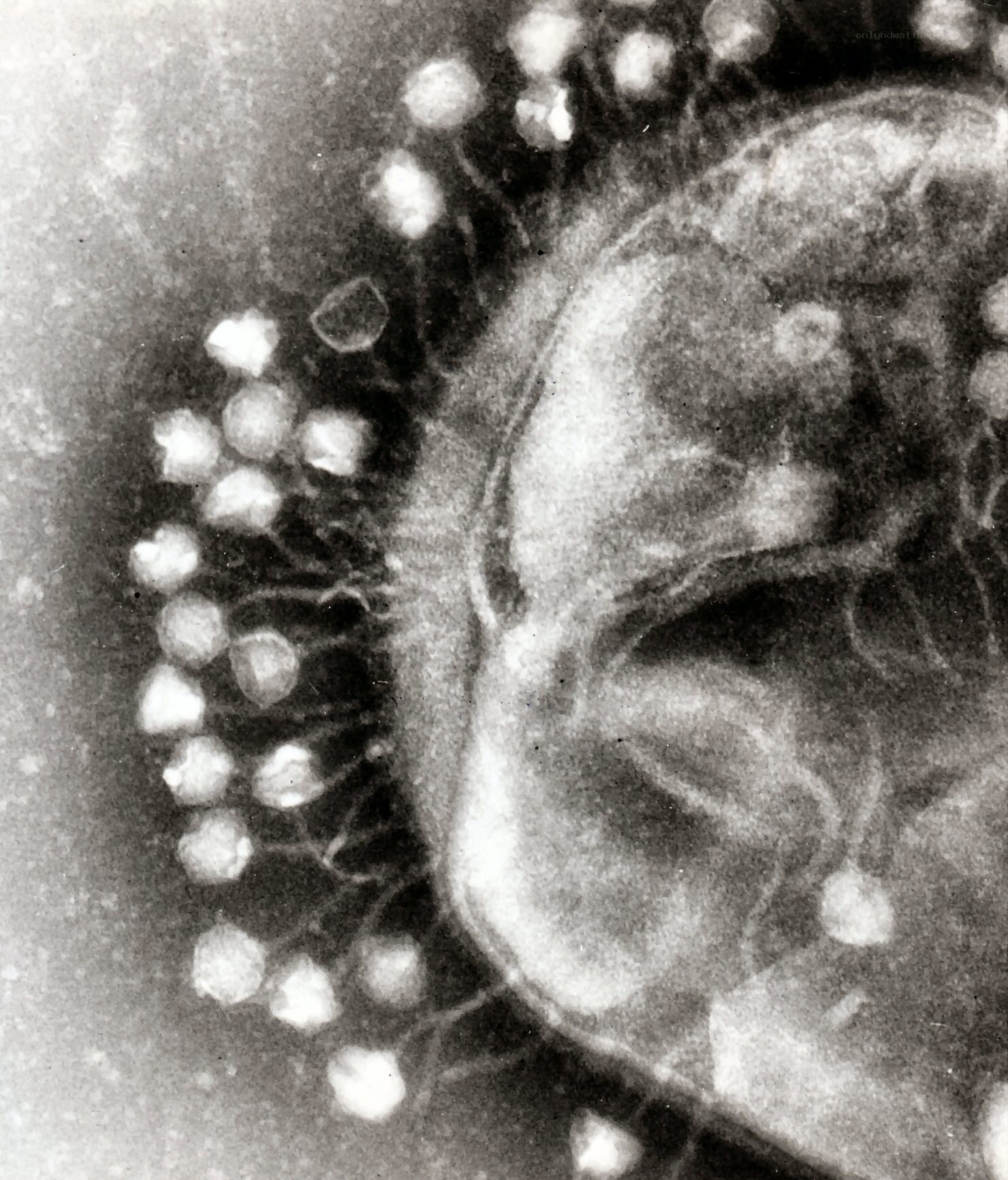 Microscopic view of virus particles