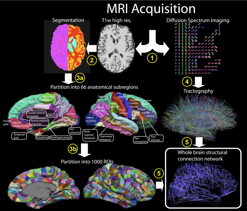 MRI brain imaging process