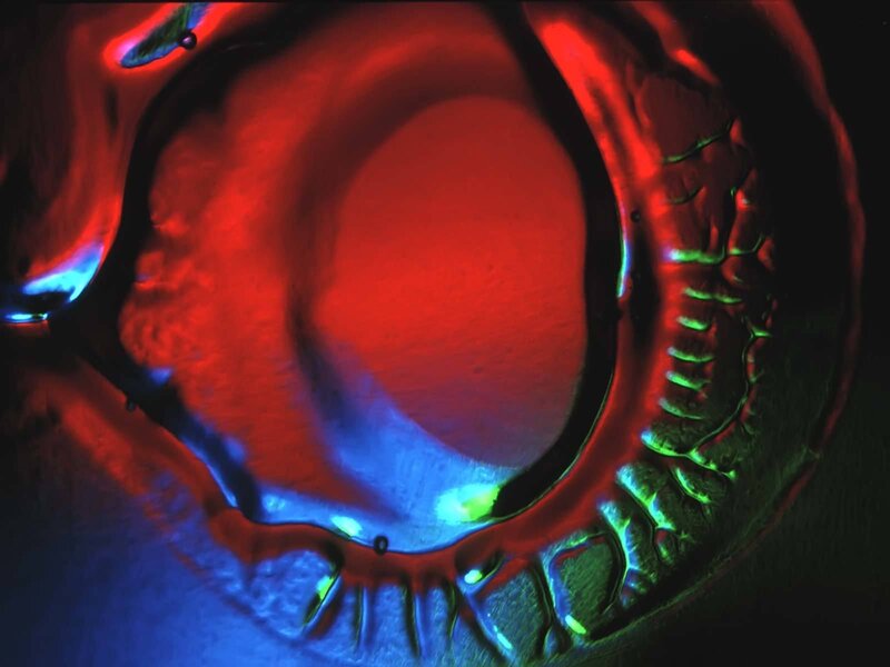 MRI scan of a knee joint