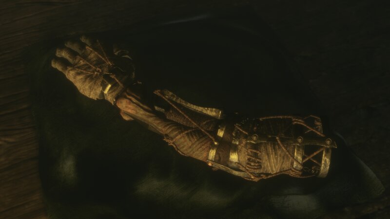Mummified Arm