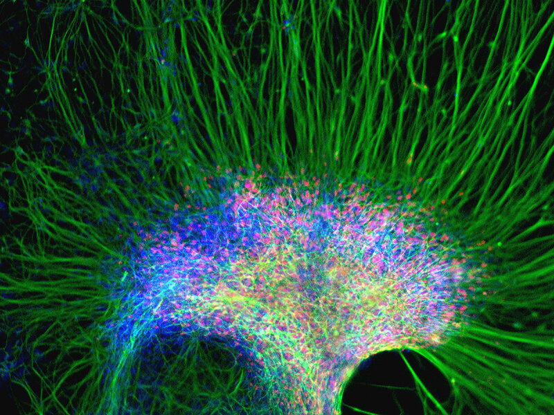 Neural network in a brain