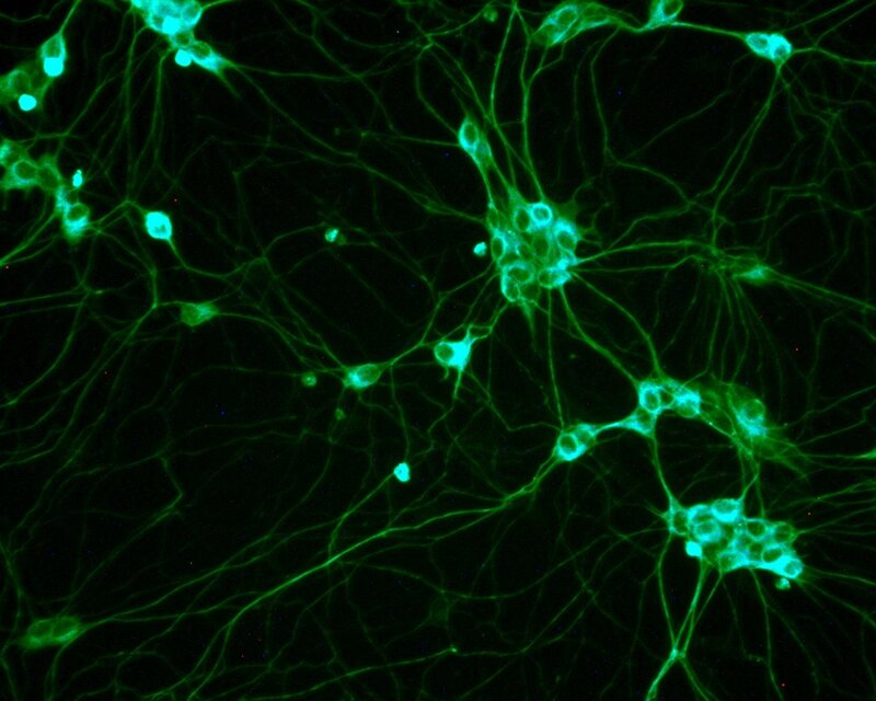 Neural network under microscope