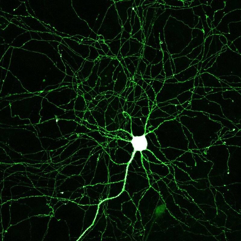 Neuron network under microscope