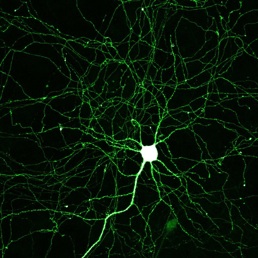 Neuron network under microscope