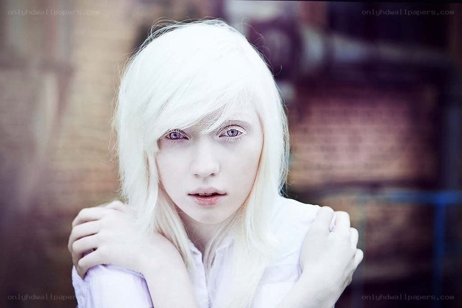 person with albinism portrait