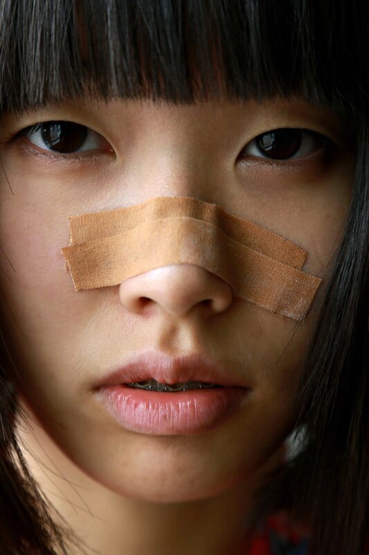 person with bandages on nose