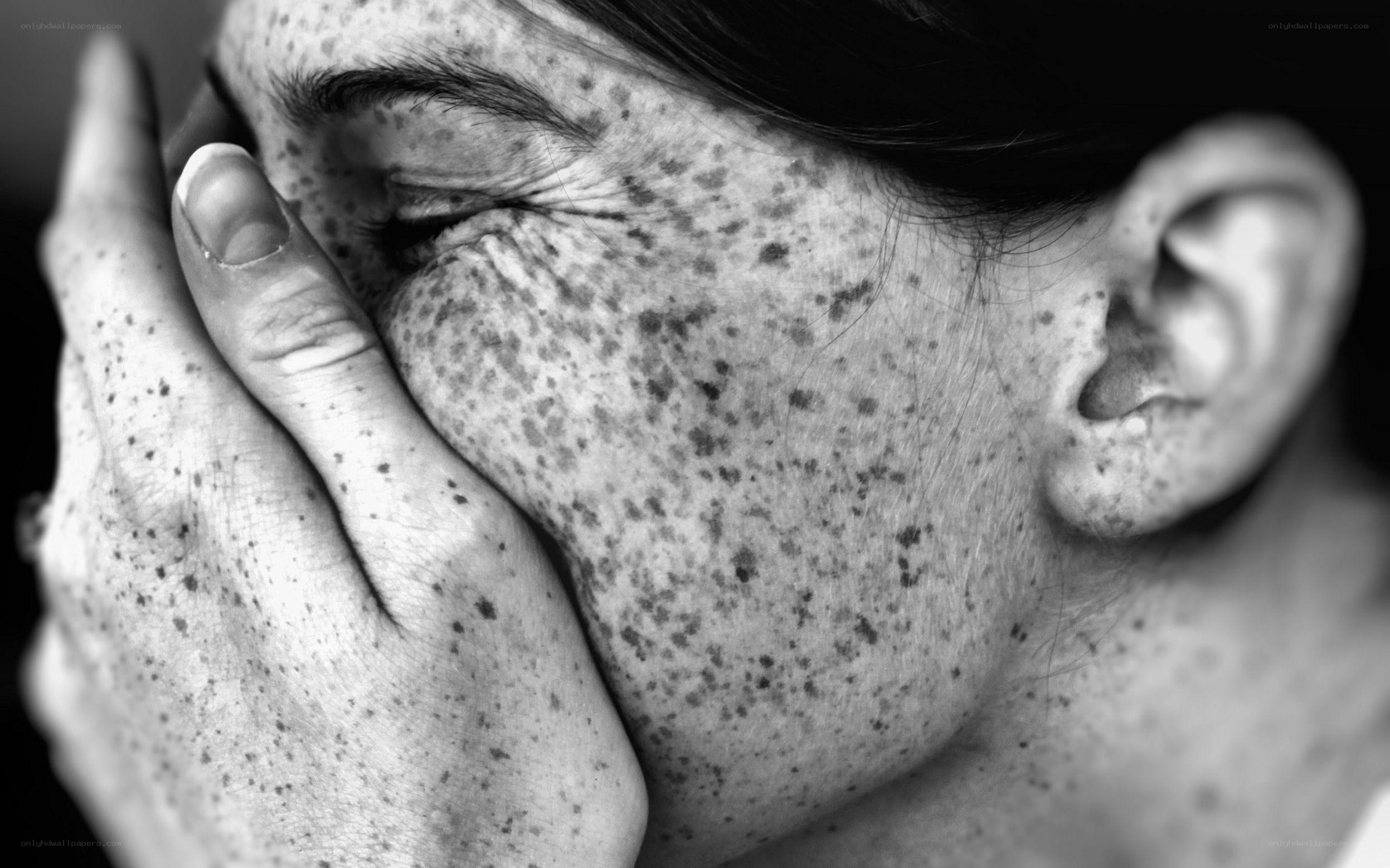 person with freckles covering face
