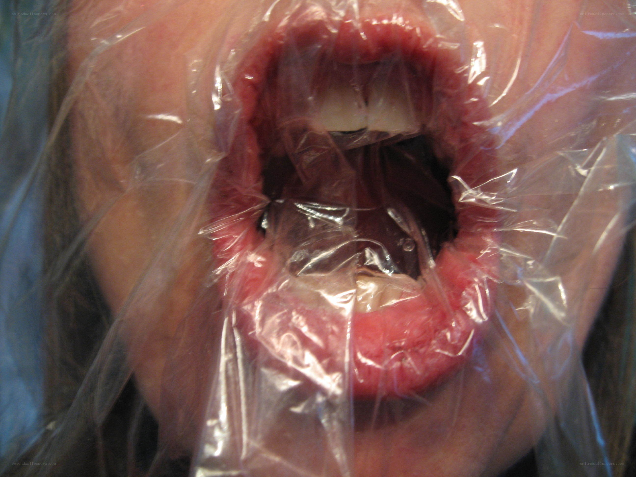 person with plastic wrap over mouth