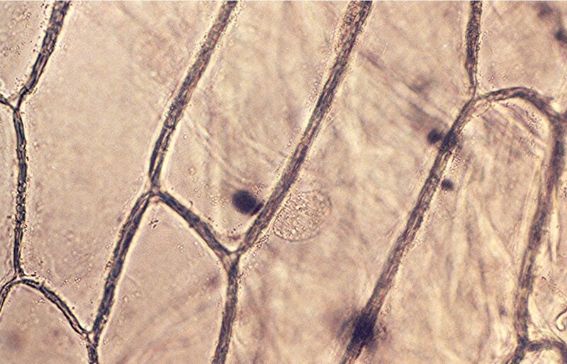 plant cell under microscope