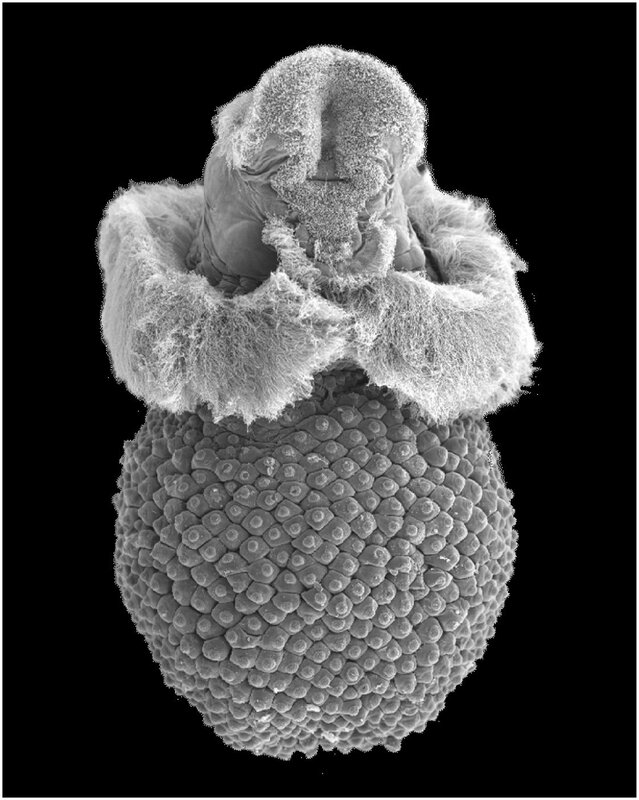 Pollen Grain under Microscope — Gray