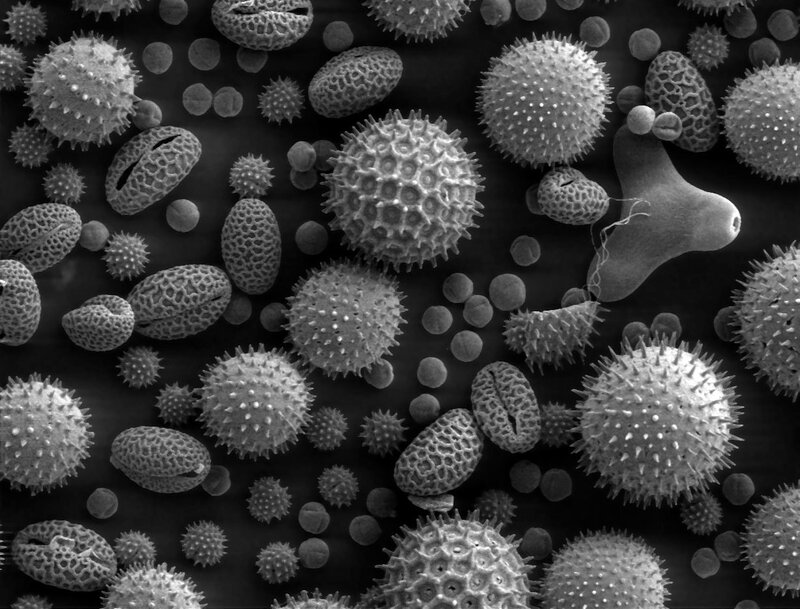 Pollen Grains under Microscope — Black
