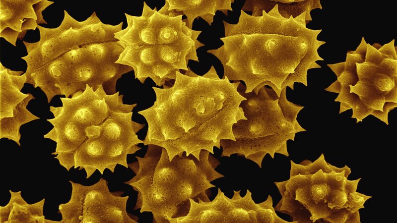 Pollen Grains under Microscope — Yellow