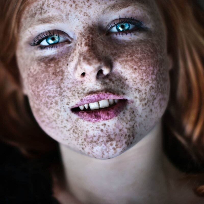 portrait of a freckled girl