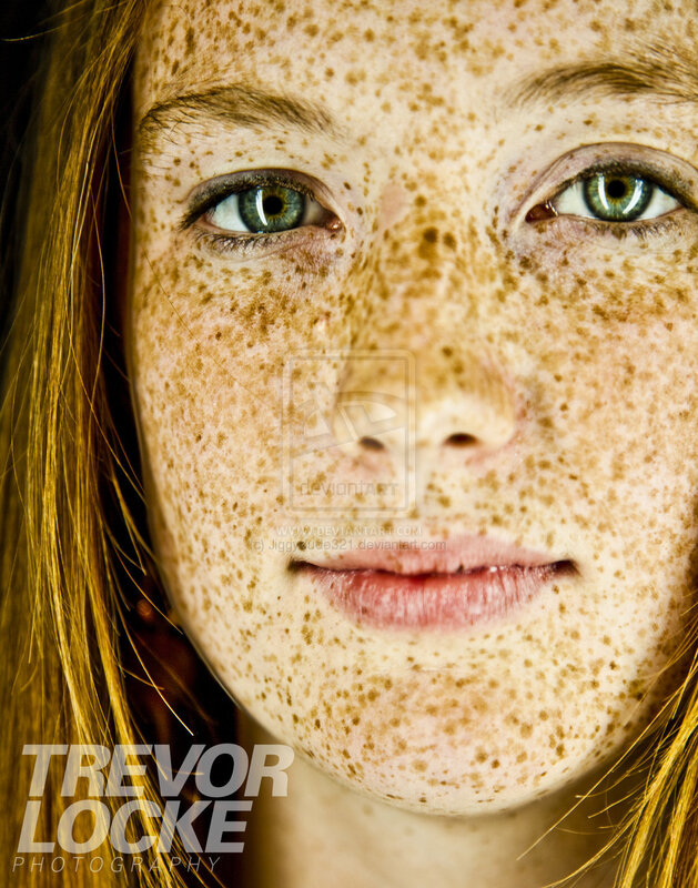 portrait of a freckled girl