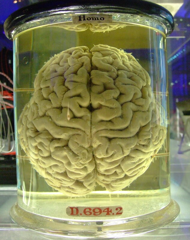 Preserved human brain in jar