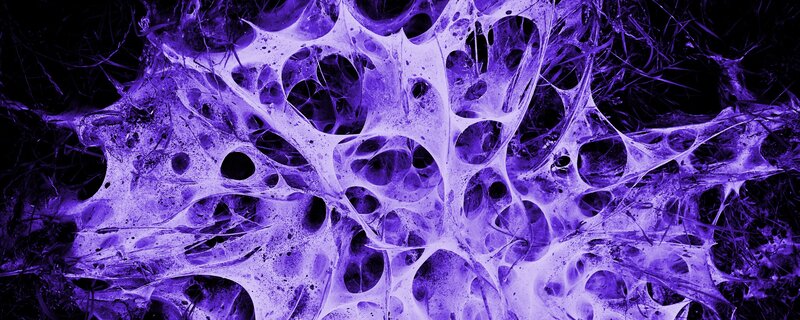 purple cellular network structure