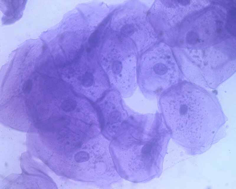Purple-stained Cells
