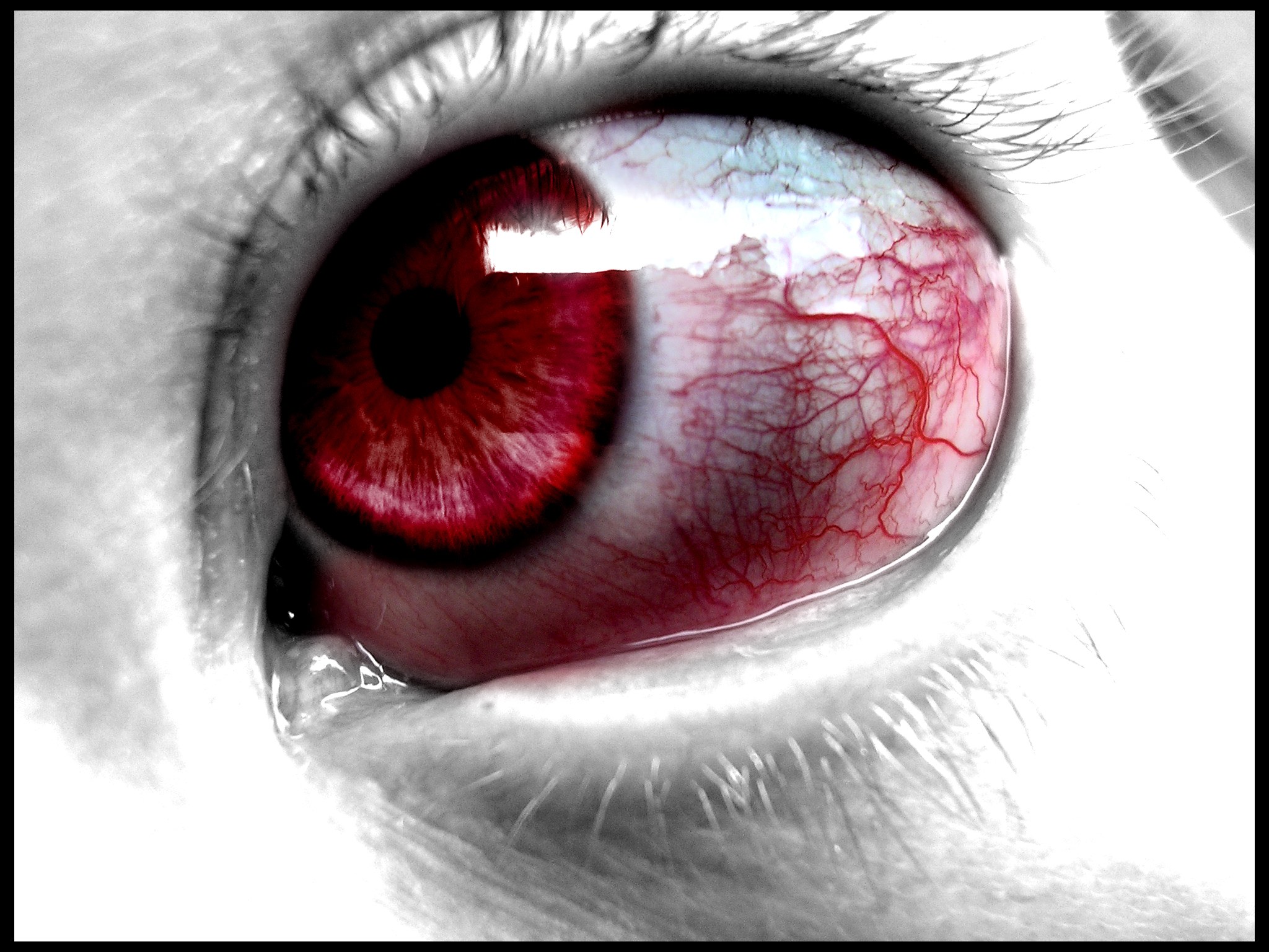 red eye with blood vessels