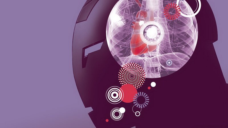 robotic heart visualization