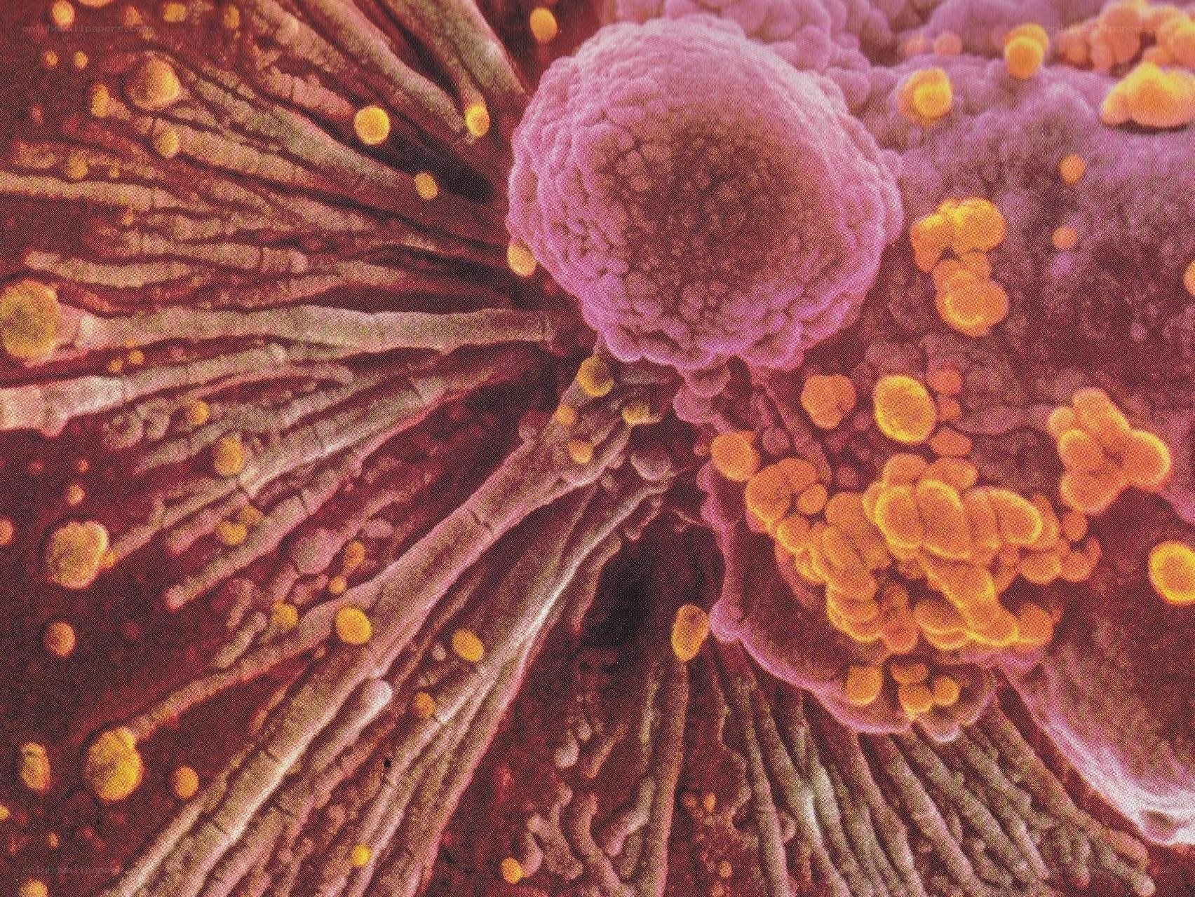 SARS-CoV-2 virus on cell surface