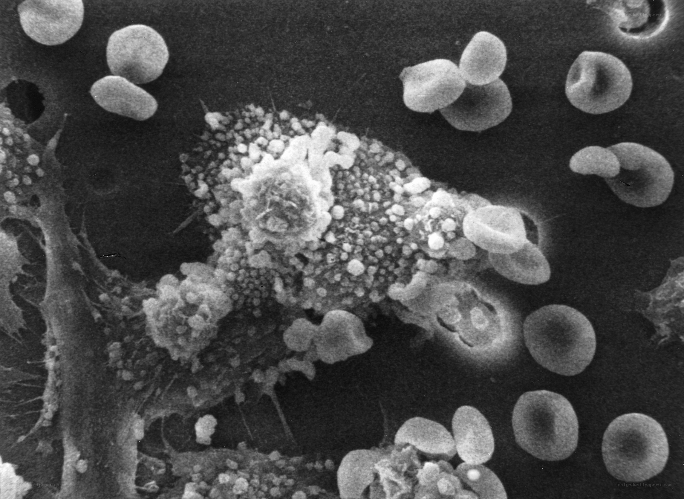 Scanning electron micrograph of blood cells