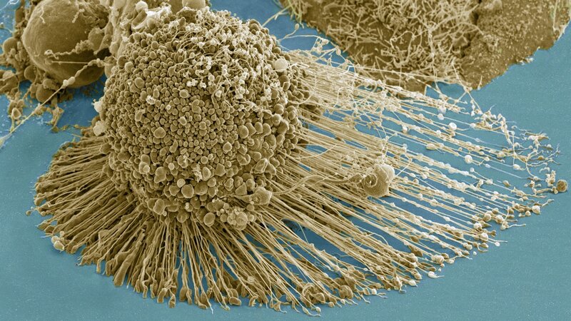 Scanning Electron Micrograph