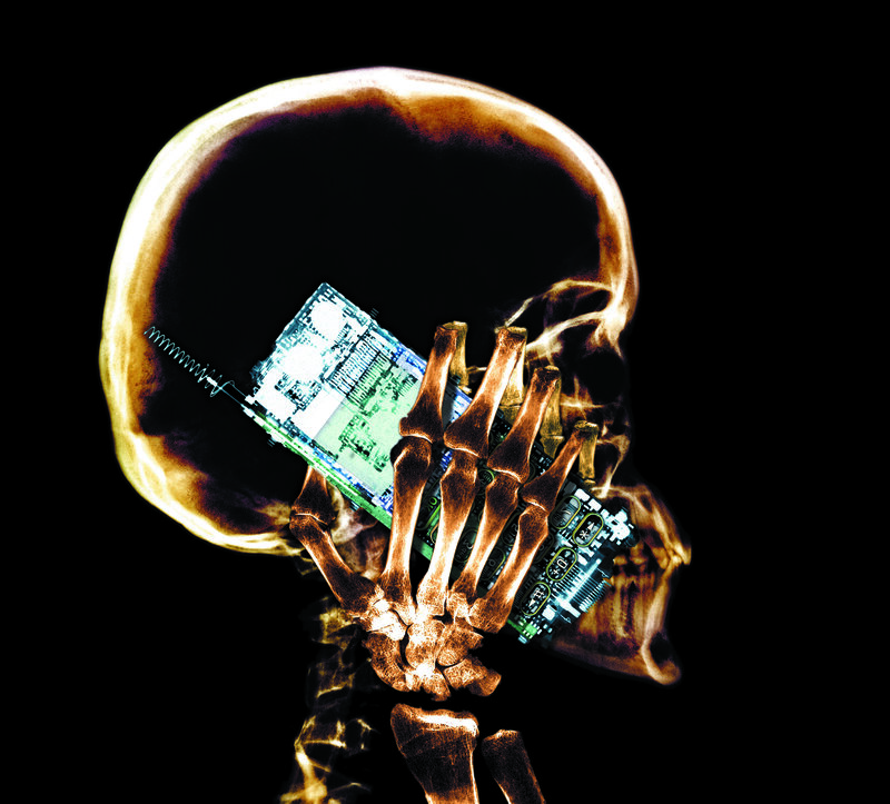 skeleton holding circuit board