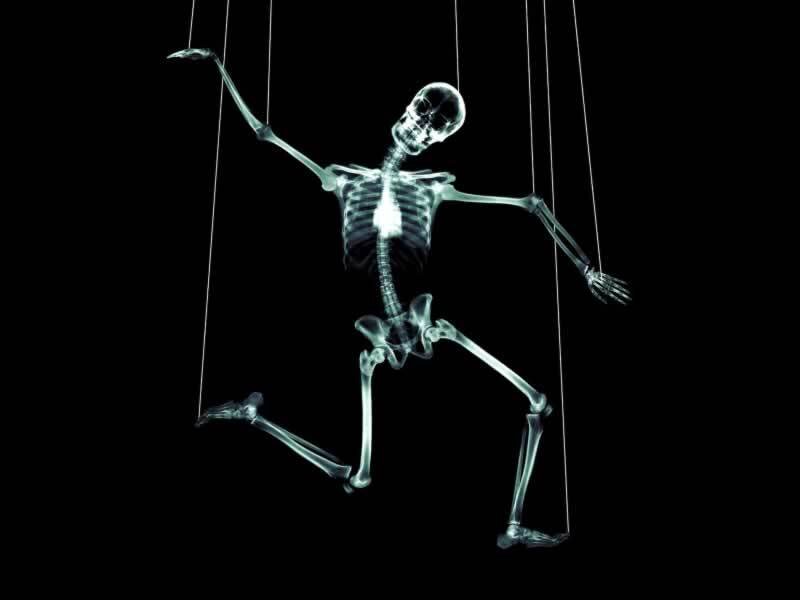 skeleton marionette x-ray