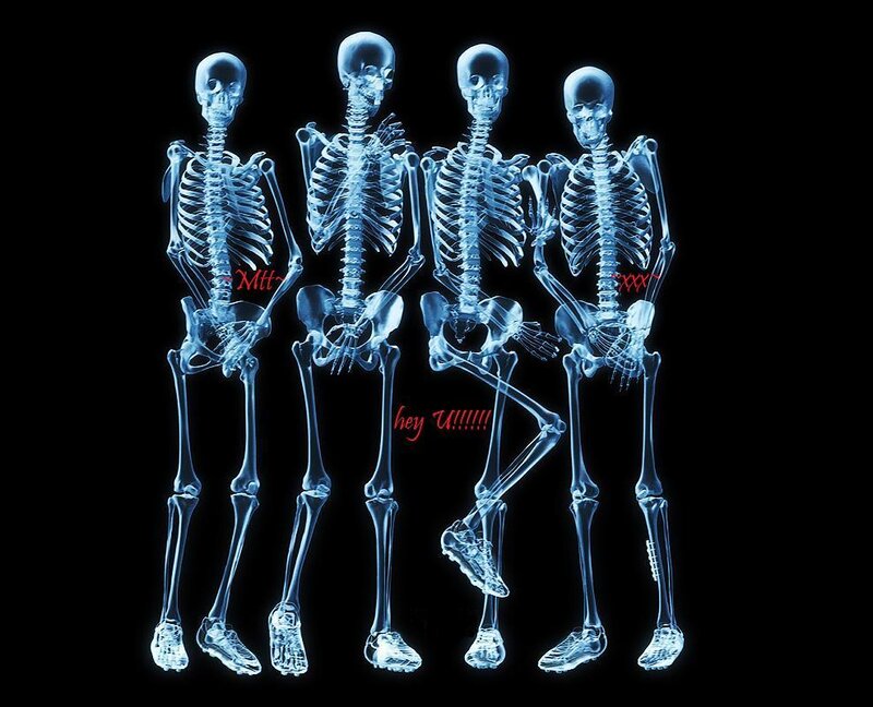 skeletons in a line