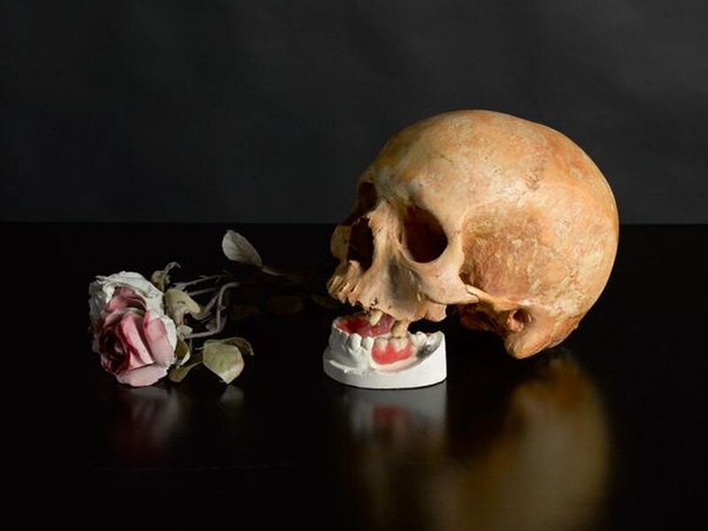 Skull with Dentures