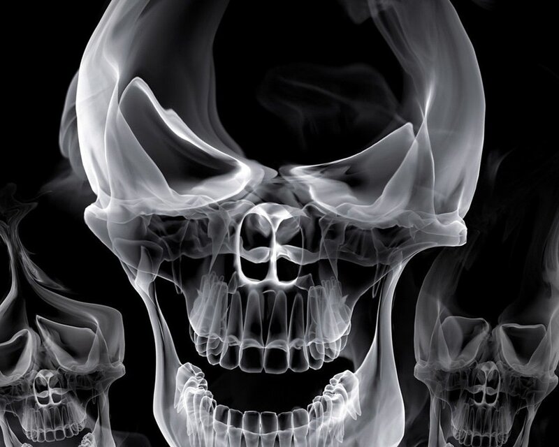 smoky skull x-ray art