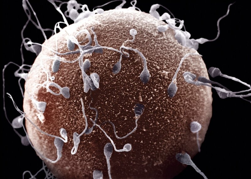 Sperm Cells Around Egg