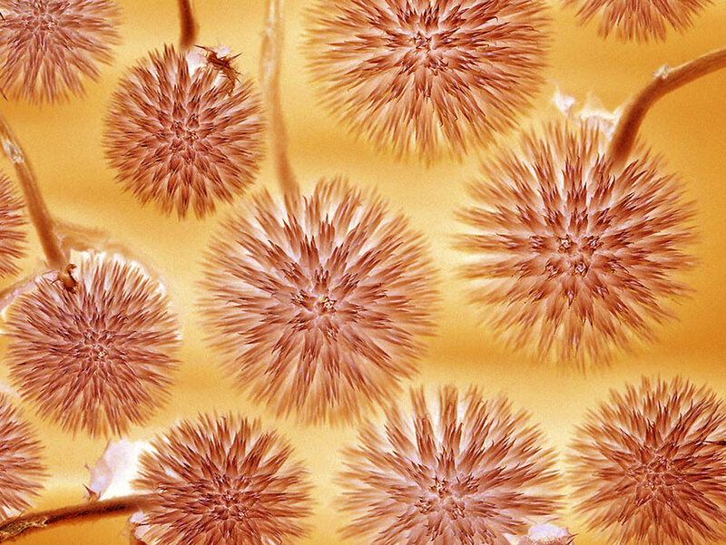 spiky pollen grains