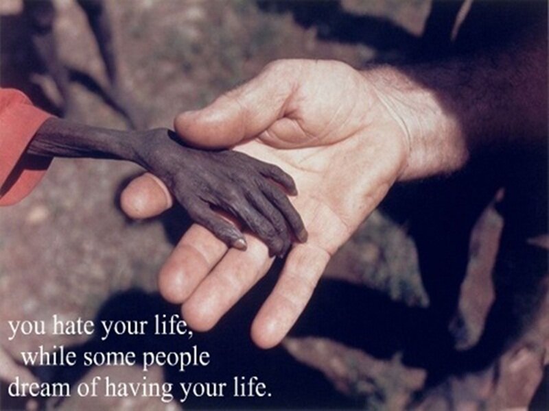 Starving Child Hand