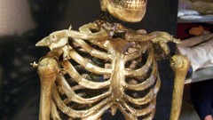 Antique skeleton high