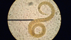 Anything like This its