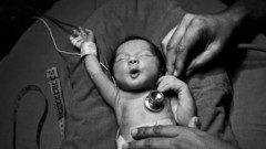 Baby monochrome stethoscopes