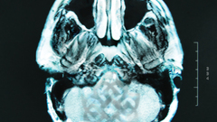 Bbdearagony hires high