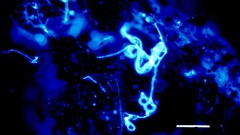 Biology fungus microscopic fluorite