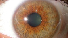 Blood sugar pancreas high