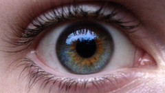 Central heterochromia example blue