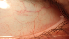 Close-up macro veiny eyelashes