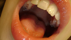 Close-up tongue teeth open