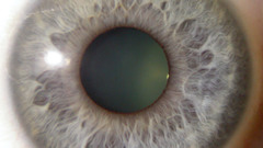 Eye high Resolution hormonal