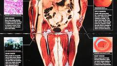 Fat anatomy infographics